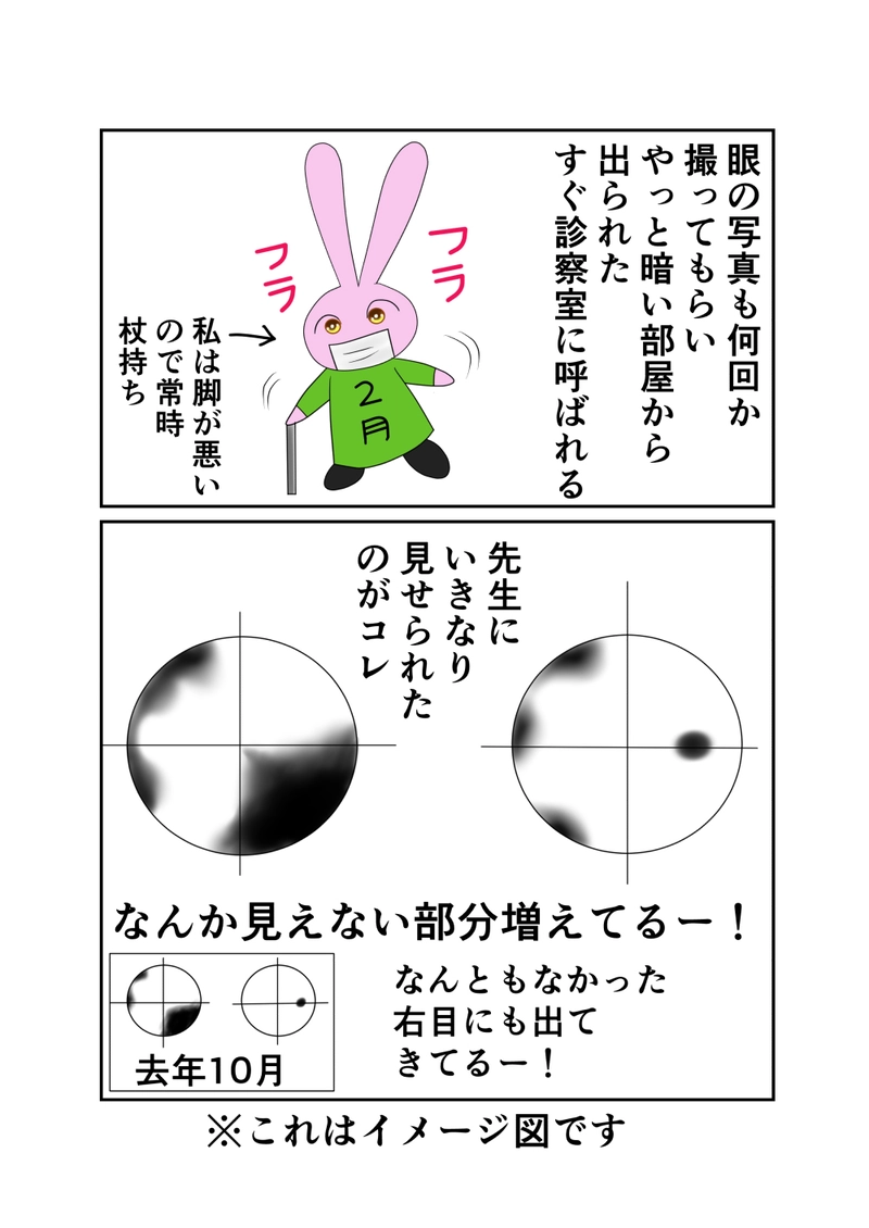 緑内障　第2話　視野検査２回目