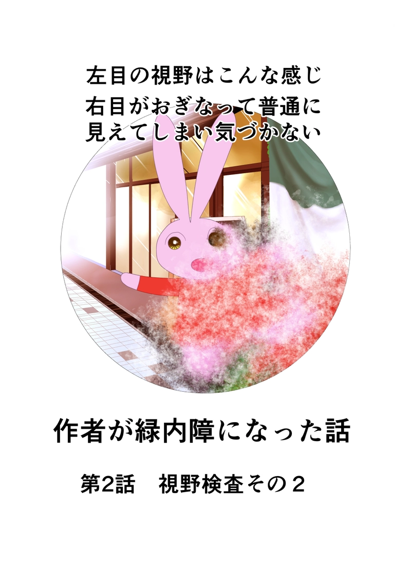 緑内障　第2話　視野検査２回目