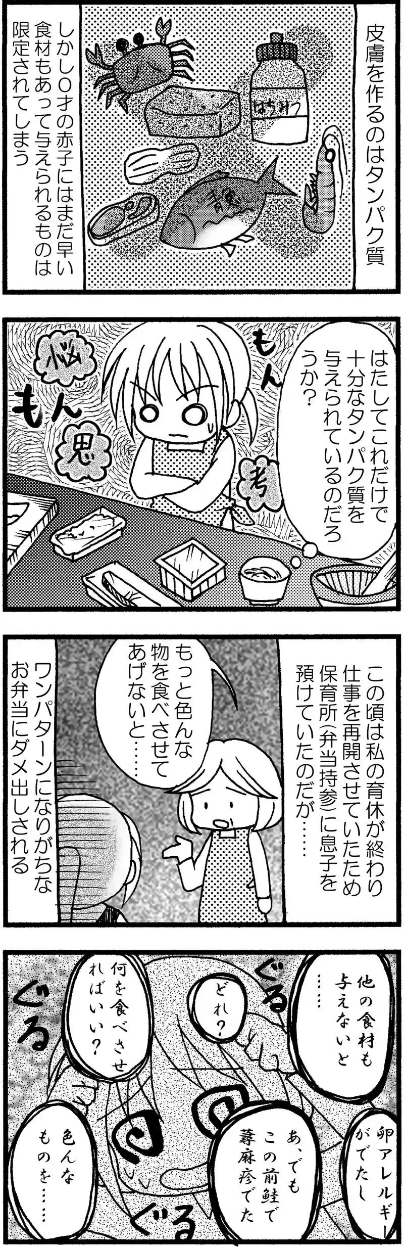 子どもが小児アトピーになったのでいろいろした話⑤