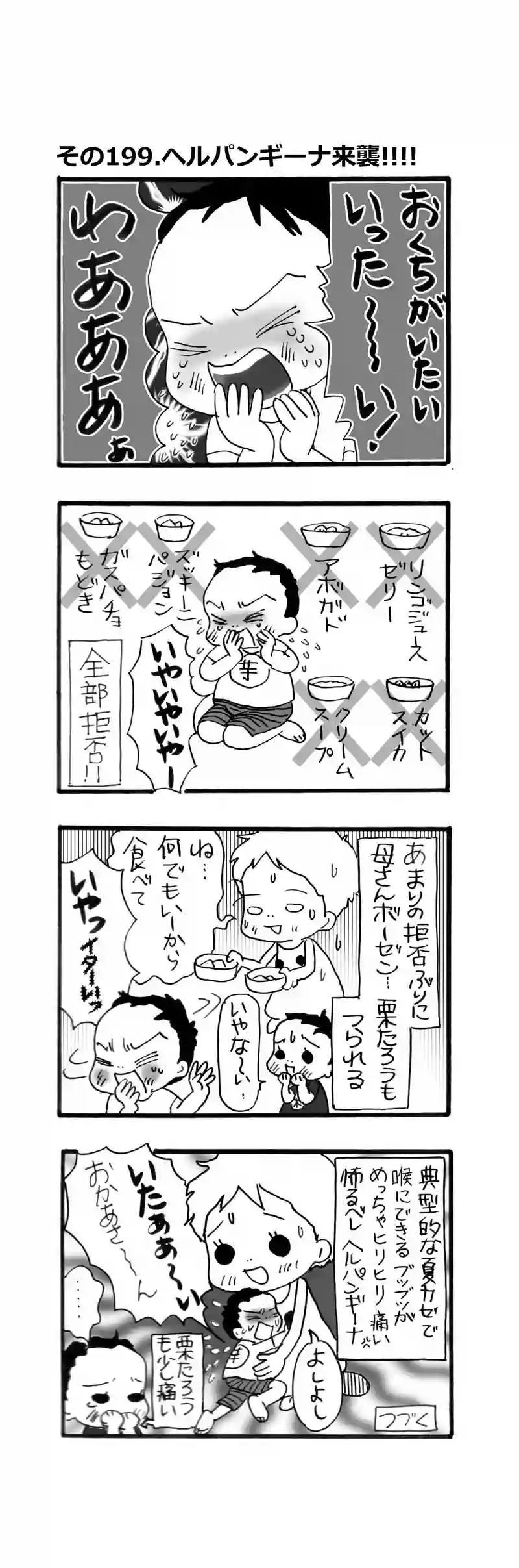その199.ヘルパンギーナ来襲!!!!!!!
