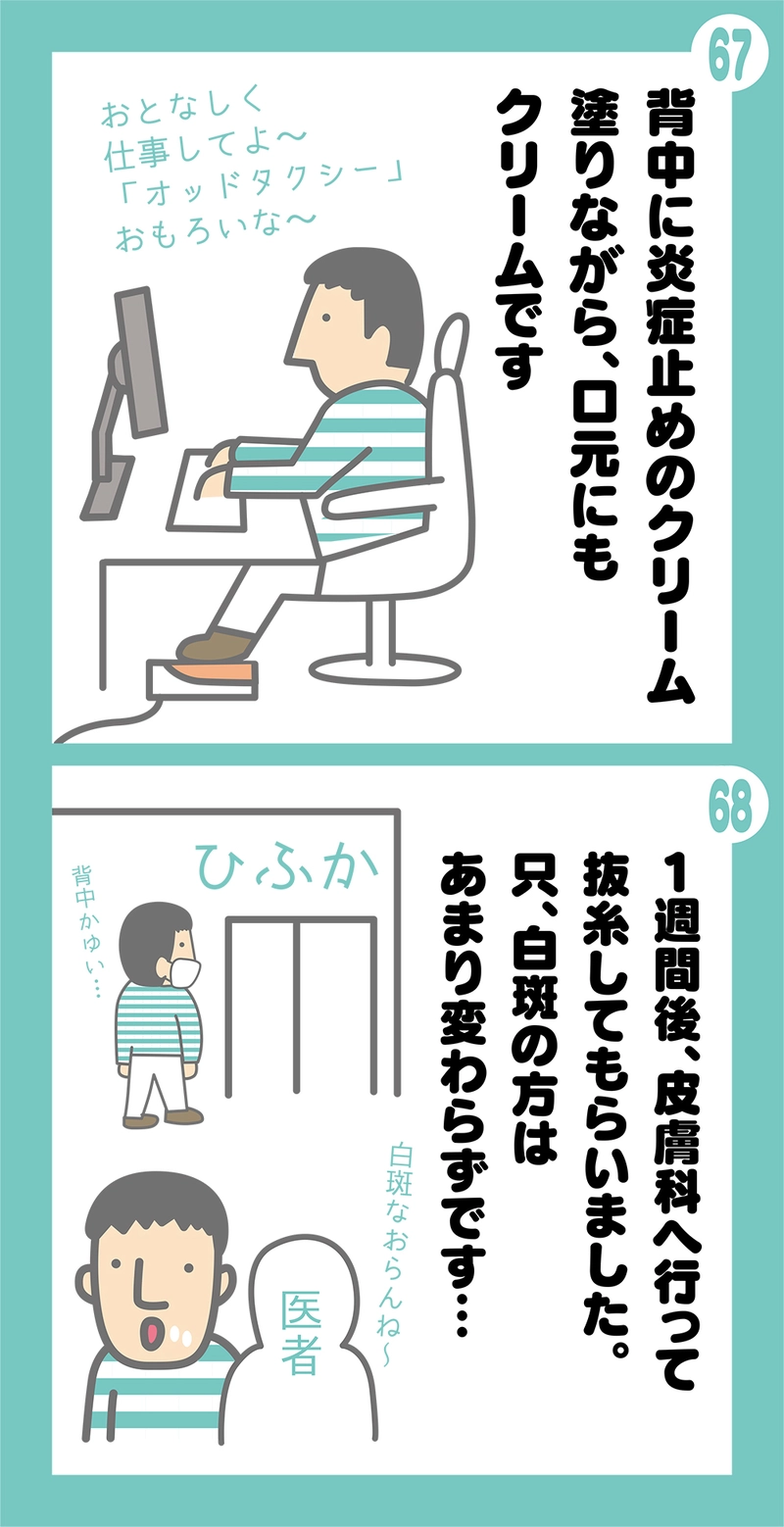 第2話 粉瘤ってなんすか？