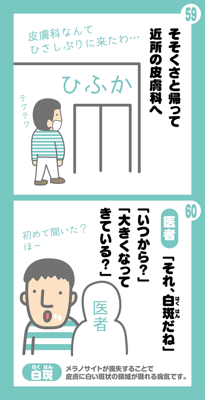 第2話 粉瘤ってなんすか？