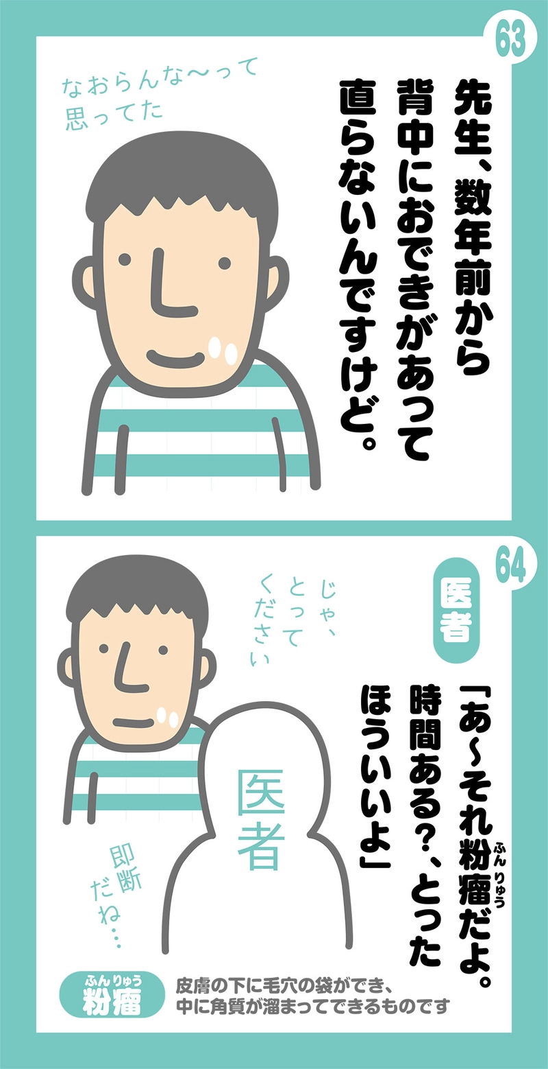 第2話 粉瘤ってなんすか？