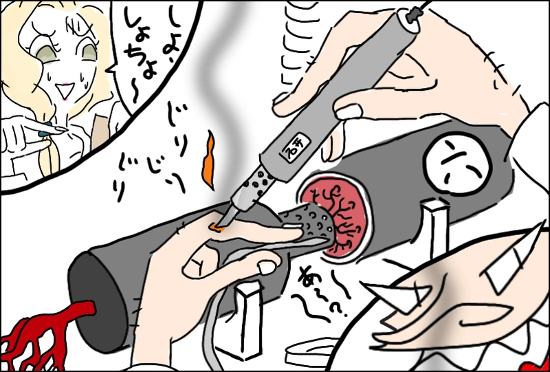 二鼻血=其ノ一のマイナス二十吾くらい