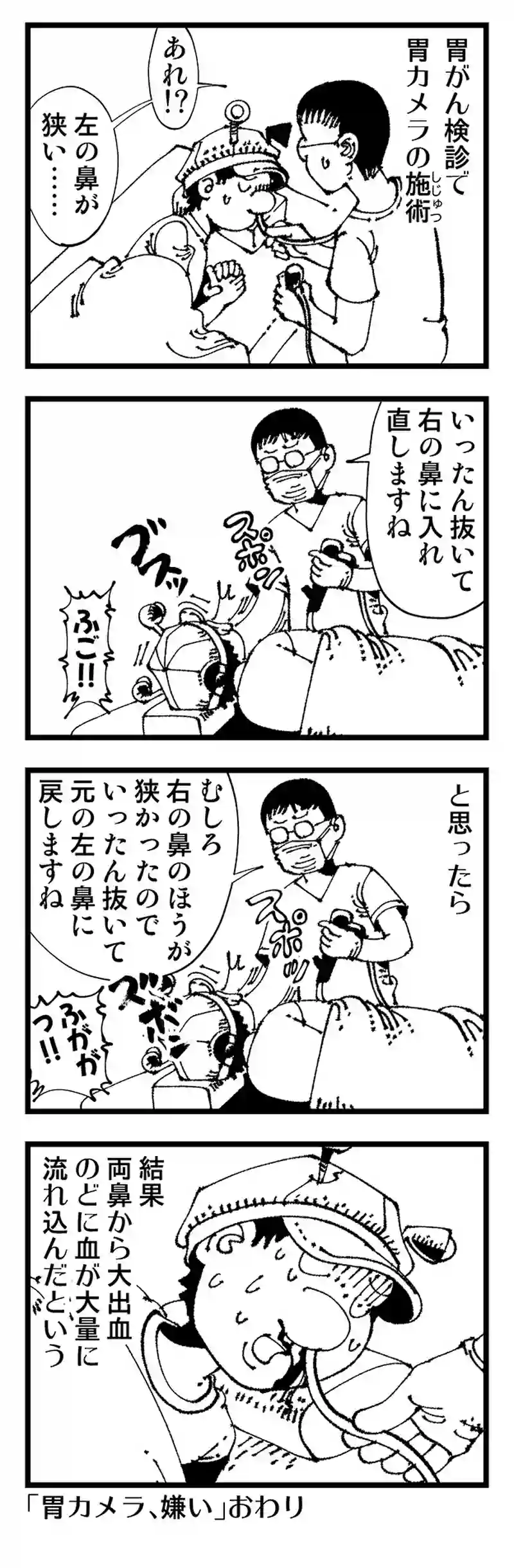 【普通】胃カメラは新種の拷問