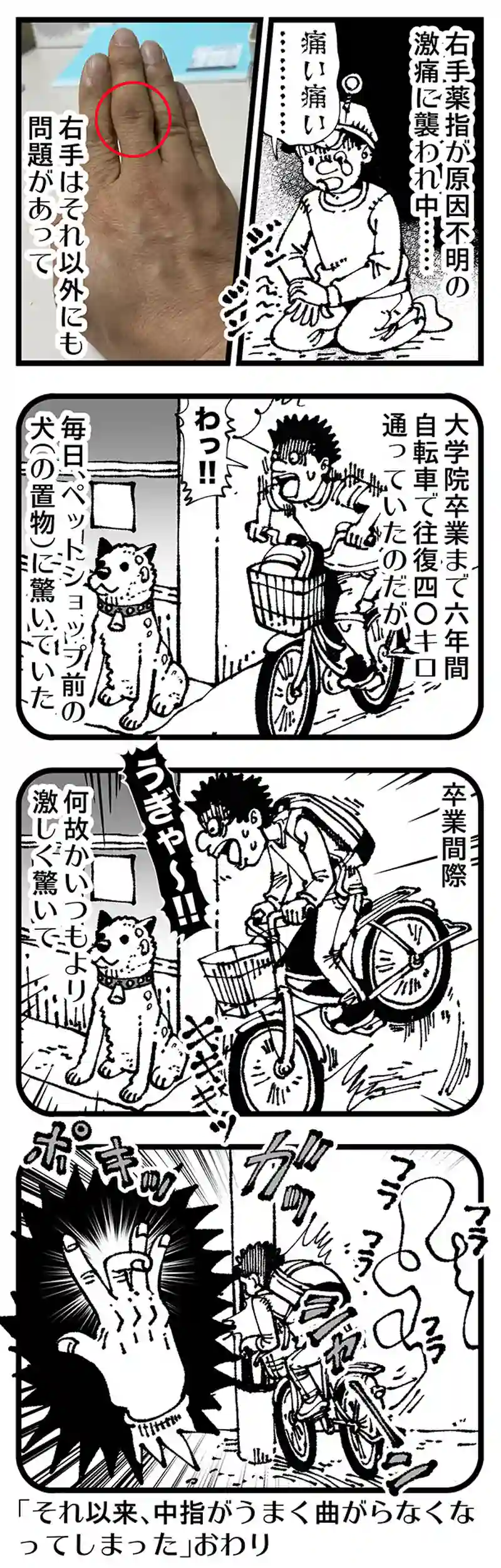 【普通】右手に襲いかかる災難
